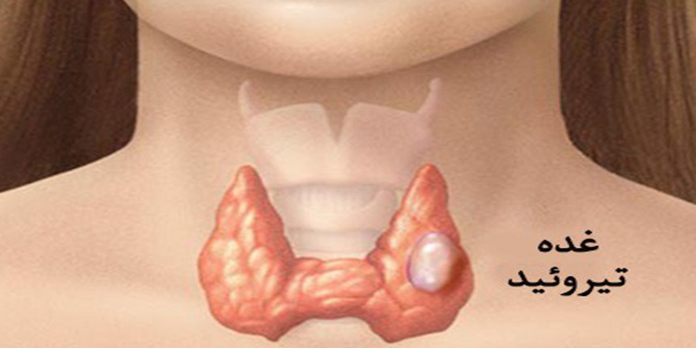 بهترین دکتر فوق تخصص غدد تیروئید در شیراز